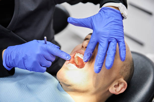 Best Emergency Tooth Extraction in Cresson, TX