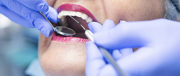 Best Emergency Treatment for Toothache in Cresson, TX